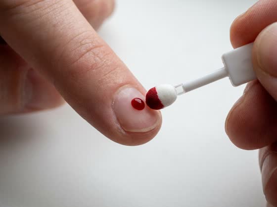 Touch the drop β The white tip touches the side of the drop and draws the blood up by itself.