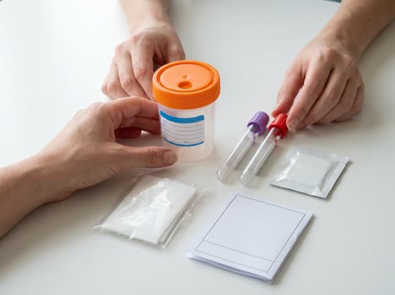 Lay it out β Cup, transfer tubes, wipe, absorbent sheet and requisition.