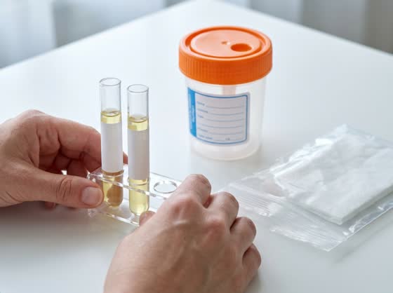 Label and bag β Label every tube, then into the biohazard bag with the absorbent sheet.